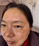 碧素堂祛斑霜美白淡化老年黃褐雀斑去斑去黑色素男士老年斑臉部手背祛斑 強(qiáng)效特效霜:一盒裝【醫(yī)用正品】 專用霜去老人斑淡化淡斑醫(yī)用正品 曬單實(shí)拍圖