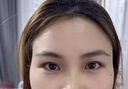 臉部凹陷填充液膠原蛋白太陽(yáng)穴眼窩淚溝凹陷填充神器面部修復精華 買(mǎi)3送2【5盒裝】不反彈 曬單實(shí)拍圖