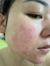 完美補水保濕乳液面霜毛孔收縮溫和改善肌膚粗糙祛痘蘆薈凝膠40g 曬單實拍圖