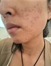 韓方五谷氨基酸洗面奶男女士控油祛痘美白深層清潔黑頭護(hù)膚品潔面乳第1名 曬單實(shí)拍圖