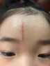 邦孚手祛疤痕專用修復(fù)去疤痕修復(fù)凝膠除疤膏疤痕增生凸起去除疙瘩祛疤膏 曬單實(shí)拍圖