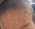 6S疤痕寧醫(yī)用疤痕膏祛疤凝膠手術(shù)剖腹產(chǎn)燒燙妊娠紋色素沉淀增生修復(fù) 【京七倉(cāng)配送】疤痕寧疤痕膏【20g/支】 曬單實(shí)拍圖