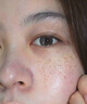 佰束美白淡斑精華霜保濕美白淡斑霜淡化黑色素去雀斑黃褐斑官方正品 30g 1盒【體驗裝】 曬單實拍圖