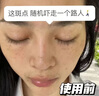 百靈鳥(niǎo)377美白祛斑霜祛斑美白淡化黑色素去雀斑老年黃褐斑男女士專用 曬單實(shí)拍圖