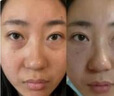 焦博士日本眼膜眼袋貼提拉緊致抗皺淡化細(xì)紋黑眼圈去眼貼膜眼袋眼紋專用 曬單實(shí)拍圖