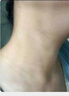 巖井昃弘脖子黑色素沉淀去除治黑棘皮癥藥膏男女胖胳膊肘腋下去黑色素神器 特效1瓶【全身黑色素去除】 曬單實(shí)拍圖