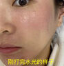 醫(yī)用械字號補(bǔ)水水光針后激光術(shù)后修復(fù)面膜臉部祛痘去痘印消炎醫(yī)美 【限時特惠】拍一發(fā)三周期裝 曬單實拍圖