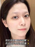 LA美國祛痘藥膏淡化痘印去痘痘和痘印痘坑修復(fù)女男士壬二酸青春學(xué)生 曬單實(shí)拍圖