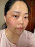 川廿制藥醫(yī)用煙酰胺凝膠美白精華液去斑祛斑美白淡化去黑色素男士專用變白 曬單實(shí)拍圖