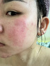 完美補水保濕乳液面霜毛孔收縮溫和改善肌膚粗糙祛痘蘆薈凝膠40g 曬單實拍圖