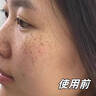 倩滋左旋vc精華凍干片發(fā)光片左旋維C保濕補水嫩滑提亮肌膚淡紋正品 2盒 【10粒VC片+10支煙酰胺精華】 曬單實拍圖