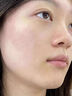 儒意（RUYI）水楊酸面膜20片祛痘淡痘印果酸控油清潔收縮毛孔女男士補水青少年 曬單實拍圖