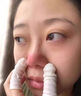 【鼻炎枕】中草藥枕頭兒童成人寶寶鼻竇炎小兒腺樣體過(guò)敏鼻涕肥大 【鼻炎/鼻竇區(qū)疼痛/鼻塞】 專用 曬單實(shí)拍圖