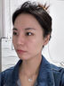 伊生優(yōu)美膠原蛋白重組醫用冷敷貼藍銅肽凍干粉六勝肽冰膜洋甘菊修復面膜 悠伊美膠原蛋白重組面膜 三盒【15片】 曬單實(shí)拍圖