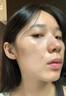 南京同仁堂祛痘膏去痘痘和痘印痘坑修復男女士改善粉刺閉口30g七夕 曬單實(shí)拍圖