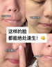 焦博士日本曬后修復(fù)面膜修復(fù)敏感皮膚屏障受損泛紅醫(yī)美用防曬傷急救白 曬單實(shí)拍圖