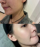 OHBT祛痘膏60g青春痘閉孔粉刺收縮毛孔專用學(xué)生男女凝膠男士化妝品 曬單實(shí)拍圖