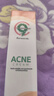 C9 healthy & beautyC9積雪草祛痘膏淡化痘印軟膏去痘坑痘疤修復凝膠男女士青春痘神器 C9Acnecream痘肌修護膏 曬單實(shí)拍圖