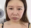 H18日本法令紋貼去除神器消除睡覺專用嘴角八字紋提拉緊致面膜男女士 曬單實拍圖