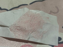 英尚（INSONG）去黑頭小蘑菇鼻貼深層清潔閉口粉刺螨蟲(chóng)導(dǎo)出液收縮毛孔套裝女面膜 小紅膜去黑頭組合神器 曬單實(shí)拍圖