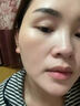 悠伊美醫(yī)用冷敷型膠原蛋面膜術后曬后敏感肌修護肌膚祛紅腫祛痘肌女 悠伊美醫(yī)用冷敷型膠原蛋敷料 二盒10片 曬單實拍圖