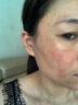 片仔癀皇后牌美白祛斑膏美白淡化黑色素老年黃褐雀斑曬斑祛斑霜護膚品女 美白祛斑膏1瓶【贈防曬霜】 曬單實拍圖