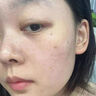 OHBT377美白祛斑面霜50g女男士保濕去黃淡化黑色素黃褐斑雀斑護(hù)膚品 曬單實拍圖