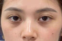 ORGINESE咖啡因眼霜淡化細(xì)紋提拉緊致搭黑眼圈重度去除眼袋男女士小黑瓶 曬單實(shí)拍圖