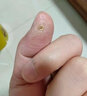 香港大藥房祛疣皂瘊尤猴子小肉粒皮膚去尤臉上脖子全身蠅子屎通用清潔手工皂 【買(mǎi)2送1】?jì)?yōu)惠升級款，全身祛 曬單實(shí)拍圖