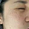 焦博士日本377祛斑霜美白淡化老年黃褐雀斑黑色素熊果苷乳膏去曬男女士 曬單實(shí)拍圖