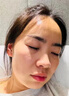 甲硝唑凝膠祛痘消炎痤瘡專用藥膏去痘痘印青春痘皮膚用藥青少年痤瘡硬疙瘩臉上下巴紅腫硬額頭粉刺炎癥性丘疹 1盒【國藥OTC】 曬單實(shí)拍圖