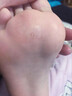 藤田制藥日本雞眼膏雞眼貼去根肉刺刺猴無(wú)痛脫落連根拔專(zhuān)用去腳跖疣20g 曬單實(shí)拍圖