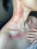 ORGINESE按摩精油刮痧spa推拿揉腰腹燃脂經(jīng)絡(luò)疏通排毒瘦身肚子神器全身 曬單實(shí)拍圖