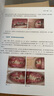 兒童替牙期矯治技術(shù)圖譜：“芝麻官”矯治器的臨床應用 曬單實(shí)拍圖
