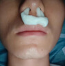 云南白藥 泰邦 TB鼻炎穴位貼敷急慢性鼻炎鼻塞流涕鼻癢鼻不適消炎成人膏藥貼 曬單實(shí)拍圖