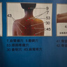 高太醫開(kāi)刃三棱針刺血排於筆全自動(dòng)放血針筆中醫用瀉血拔罐美容院養生館 三棱針刺血筆+5支小號針+5支中號針+10筆帽+圖 曬單實(shí)拍圖