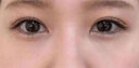 焦博士日本眼膜眼袋貼提拉緊致抗皺淡化細(xì)紋黑眼圈眼貼膜補(bǔ)充膠原蛋白 曬單實(shí)拍圖