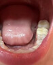李時(shí)珍防蛀牙膏蛀牙洞修復(fù)齲牙齒成人兒童殺蟲修復(fù)齒洞清理黑線蟲牙爛牙 專用的藥【一盒裝】試用裝 曬單實(shí)拍圖