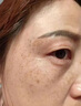 巖井昃弘祛斑專用醫(yī)用正品男士去斑去黑色素去年人臉部手背效果最好的產(chǎn)品 一盒裝【去老年斑的藥強力祛除】 祛斑霜美白淡化老年黃褐雀斑 曬單實拍圖