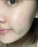 SUMDOY日本進口面膜亮白淡紋淡斑保濕補水緊致抗皺提亮膚色控油祛痘痘印 【體驗裝】控油祛痘一盒*5片 曬單實拍圖