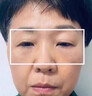 焦博士日本眼膜眼袋貼提拉緊致抗皺淡化細(xì)紋黑眼圈去眼貼膜眼袋眼紋專用 曬單實拍圖