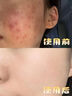 花肌粹氨基酸洗面奶女潔面祛痘深層清潔毛孔保濕二合一青少年專用學(xué)生 曬單實(shí)拍圖