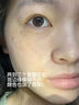 XODO熊果苷乳膏美白祛斑霜淡斑去斑淡化黑色素去雀斑黃褐斑去斑霜男女 2支裝【拍2發(fā)4】到手4支 曬單實拍圖