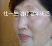 碧素堂祛斑霜美白淡化老年黃褐雀斑去斑去黑色素男士老年斑臉部手背祛斑 強(qiáng)效特效:買二送-【快速淡斑】 專用霜去老人斑淡化淡斑醫(yī)用正品 曬單實(shí)拍圖