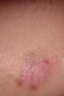 陰囊潮濕瘙癢男人私處專(zhuān)用止癢去草根大腿根內側睪丸濕疹出汗非藥 20ml 3瓶 膏藥【可試用1盒】 男士私處殺菌消炎止癢噴劑 曬單實(shí)拍圖