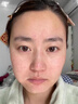 MN淚溝填神充器豐盈額頭太陽(yáng)穴眼窩臉頰凹陷淡法令紋魚尾紋眼部精華 3盒裝【淚溝精華填充凹陷】 曬單實(shí)拍圖