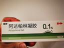 麗芙阿達(dá)帕林凝膠35g+甲硝唑銼凝膠30g去黑頭修復(fù)毛孔收縮毛孔粗大祛痘印修復(fù)淡化痘印痘坑修復(fù)藥膏 曬單實(shí)拍圖
