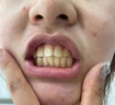 維特絲美亮白牙膏口臭去黃去牙漬去煙漬牙垢護(hù)齦清新口氣熱銷金榜第一名 曬單實(shí)拍圖