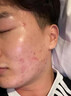 MOIHANR美白洗面奶男士專用變白控油祛痘除螨蟲去黑頭收毛孔去角質(zhì)潔面乳 【美白去黑  控油祛痘】一瓶裝 曬單實拍圖