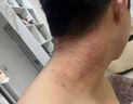夫潔美寶濕毒清濕疹止癢去根濕毒清軟皮炎濕疹皮癬真菌感染止癢膏十大牌子 苗藥頑固-藥膏-7盒-廠家直發(fā) 曬單實(shí)拍圖